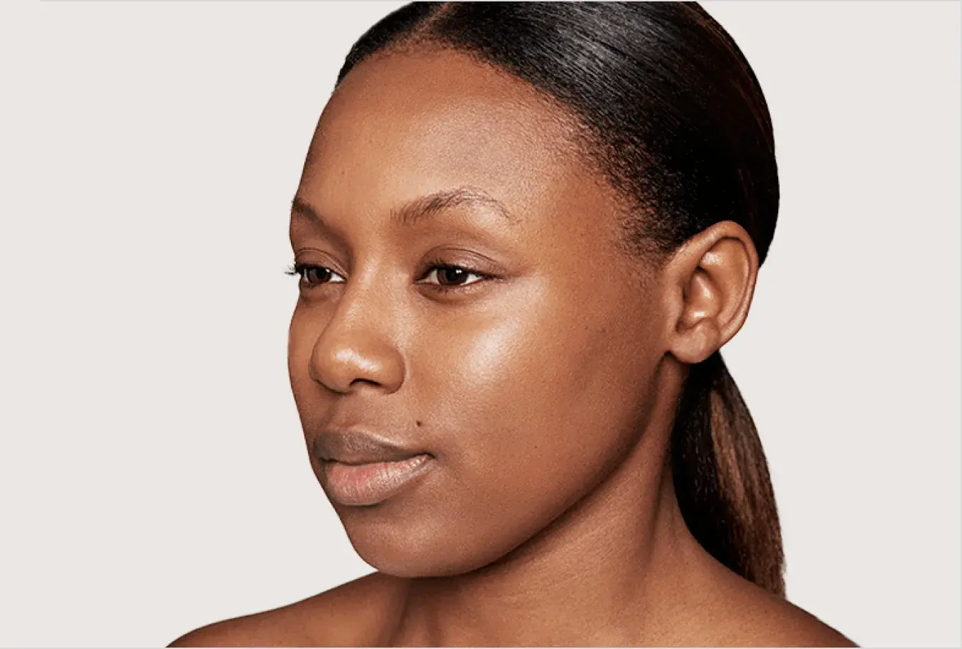 Salimah before and after Dysport treatment — after